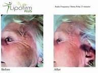 Natural Skincare Solutions Organic Facials 45 Minute Skin analysis & Re-vitalising Facial 16.