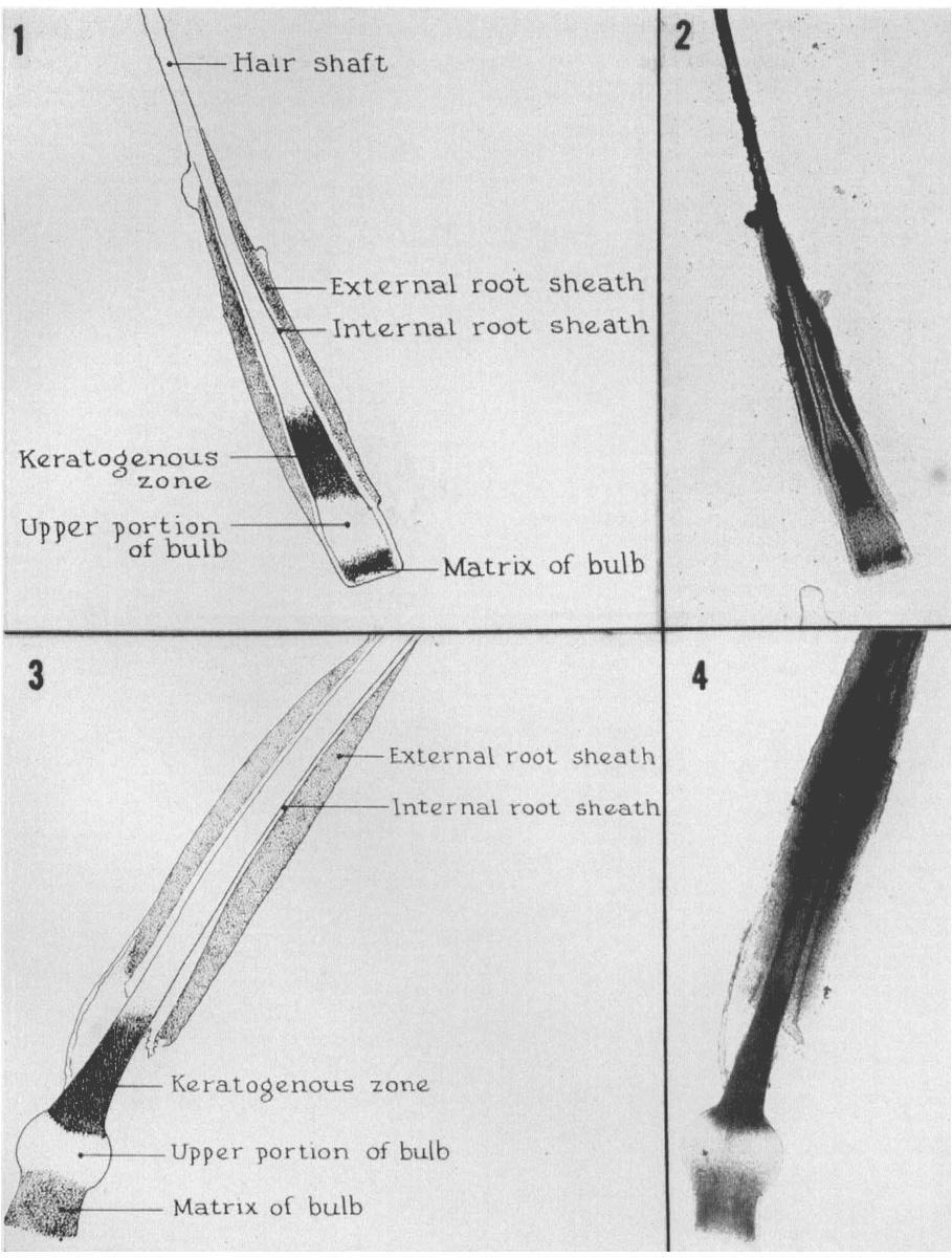 Normal anagen root of scalp hair without bulbar portions of external and internal sheaths. X41. (Table 1). No correlation of age or sex to proportion of growing hairs could be made in this group.