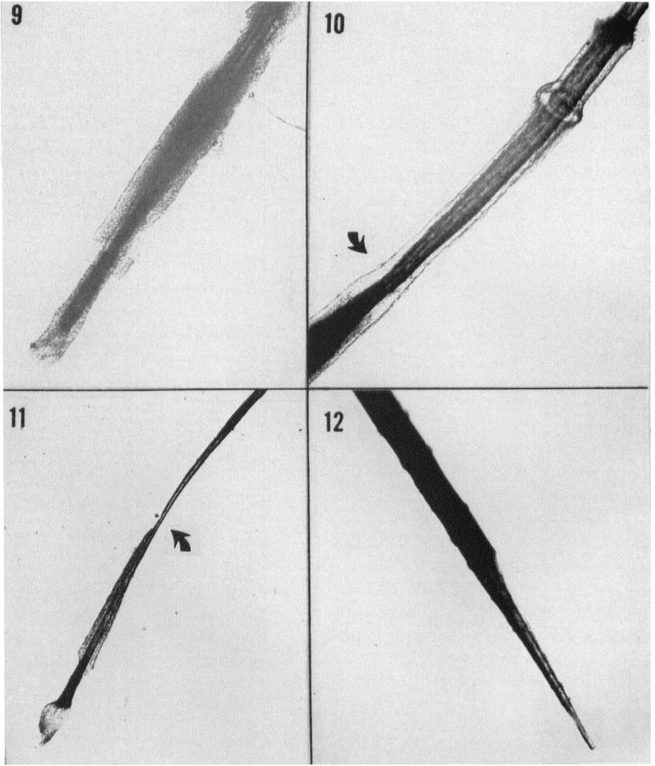 Constriction in distal portion of shaft of scalp hair fourteen days following amethopterin therapy. X27. FIG. 12. Hair broken at site of severe constriction in shaft induced by amethopterin. X80.