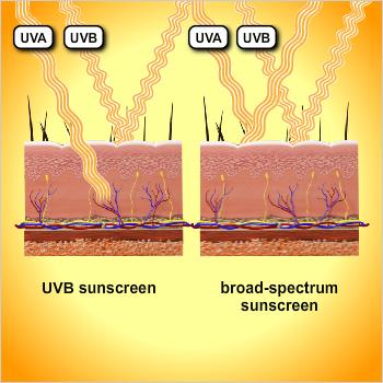 Types of Sunscreen and How They Work Sunscreens can be classified by how they protect against UV light as well as by the type of UV protection they provide.