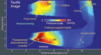 objective anatomical/biomechanical and functional measures for vaginal characterization.