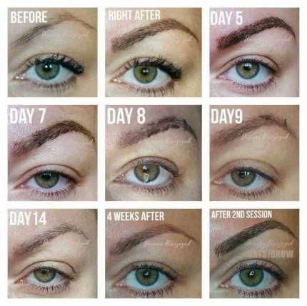 1. The day after: When your new brows are completed, they will appear too dark. This is temporary. You are seeing pigment in both layers of your skin (epidermis and dermis).