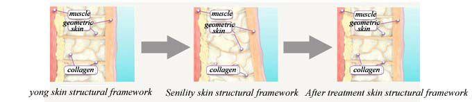contraction, tighten skin, and reduce cellulite.