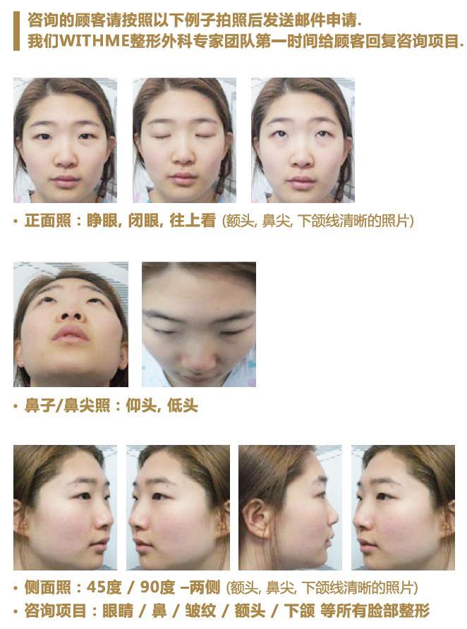 JK WITHME Clinic Online Consultation Online Photo Consultation > Doctors & Medical Team Check the Pictures > Sending Answers 1. Front shot looking straight 2.