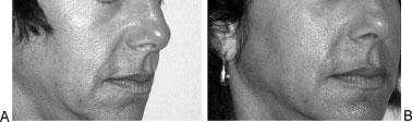 1 7). Figure 6 A 41-year-old woman: (A) no previous treatments; Figure 2 A 43-year-old man: (A) no