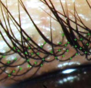 on a biomicroscope 2 Counting the number of lashes in the specific area to be analyzed