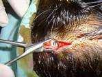 In this plane, one has to avoid taking temporalis fascia that is located below the needle.