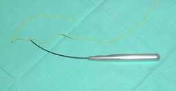 10 Miniinvasive Face and Body Lifts Closed Suture Lifts or Barbed Thread Lifts traumatise or cut the sutured tissue.