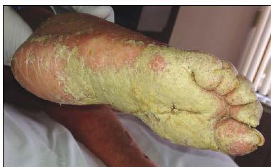 Appendix A Does your resident have a skin condition that is not responding to treatment?