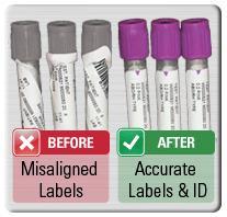 Labeling and Handling Requirements Label all tubes immediately after collection with patient s name, medical record, location, date, time, and your initials.