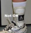 Ankle braces with straps Ankle braces with straps are allowed if there are no hard