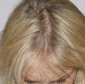 The practitioner may suggest additional treatments to keep hair