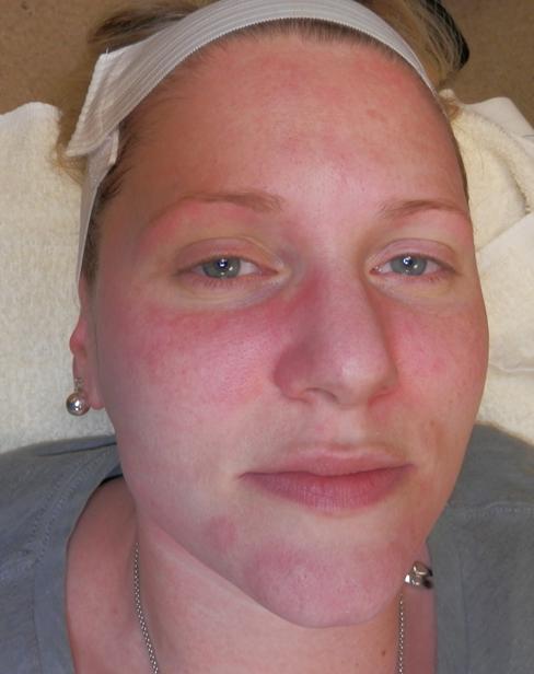 ongoing correction of pigmentation, redness, and sensitivity ++ Natural-looking coverage
