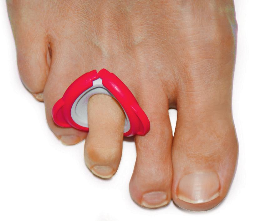 treatment of the toe or finger.
