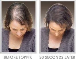 63 P a g e HOW HAIR CONCEALERS WORK A lthough hair concealers are not a permanent solution to hair loss problem, yet it helps to save you from the embarrassment by disguising the baldness.