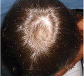 treatments have the dynamics to remedy all hair-related issues with no side effects.