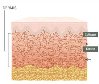 How the Treatment Works (Cont d) Slight heat is generated by fragmenting the Carbon which penetrates the Dermis leading to Collagen denaturation A series of treatments (6 months or more) can