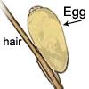 Nits are firmly attached to the hair shaft and are oval-shaped and very small (about the size of a knot in thread) and hard to see.