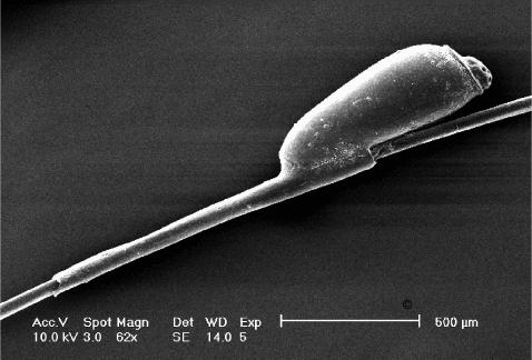 Figure C: Live unhatched head louse egg attached to a hair shaft Source: Sally Speare and Rick