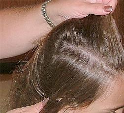 Treating Head Lice To remove nits: Part and lift hair to check for nits or lice Work under a