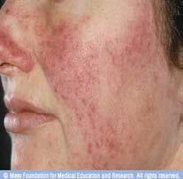 Dermalogica Facial Treatments Luxury Dermalogica Customised Skin Treatment 39.