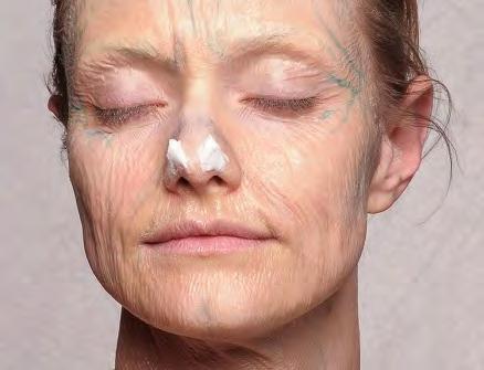 Step 17 Apply a layer of the Pros-Aide Paste to the end of the nose with a