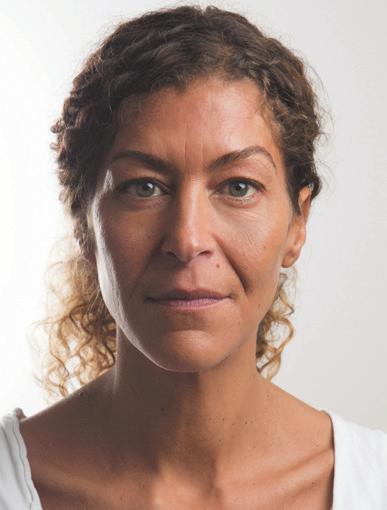 FULL - FACE TREATMENT CASE STUDY Valérie 42 years old BEFORE Valérie 42 years old AFTER ASSESSMENT Atrophy of the fat layers above the nasolabial fat pad which increases the nasolabial line and