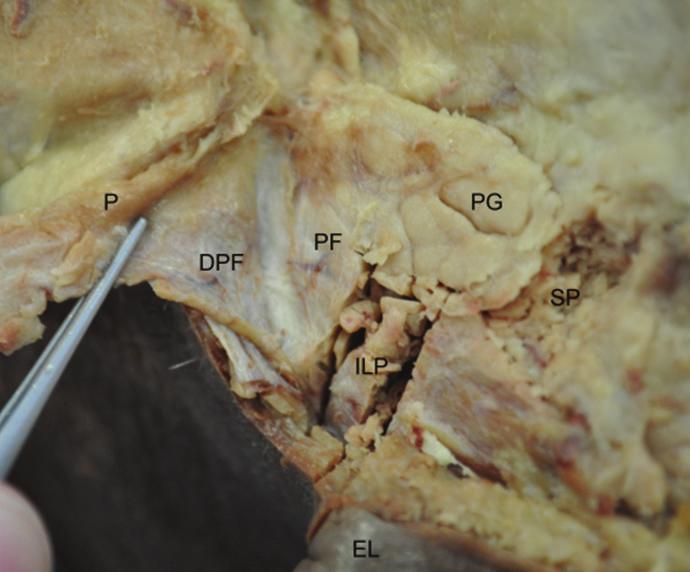Anatomy 3 3.7. Platysma. An irregular array of fibrous septae was present in the superficial adipose layer of the facial and cervical platysma tissue samples.