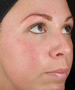 /Treatment Makeup DERMATOL OGIST DEVELOPED Natural-looking. Confidence-boosting. Uneven Pigment Uneven Tone Perfection.