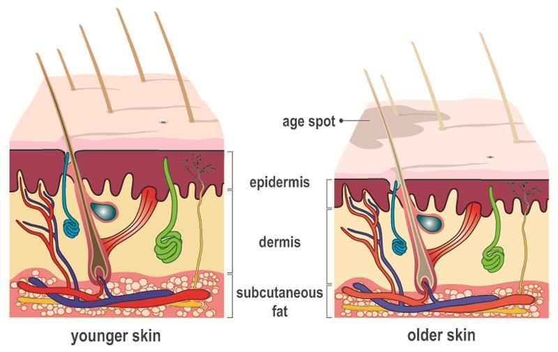 Changes in the older skin and consequences Epidermal turnover slows = Thinner skin Less effective barrier function = More prone to infection/dryness Less flexible and softer collagen = More prone to
