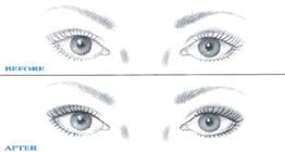 BEFORE AFTER Eyelining Gives various effects to eye upon application. 1. Thin line at lashes, thickens appearance of lashes. Hold outside corner of eye with fingertip when applying. 2.
