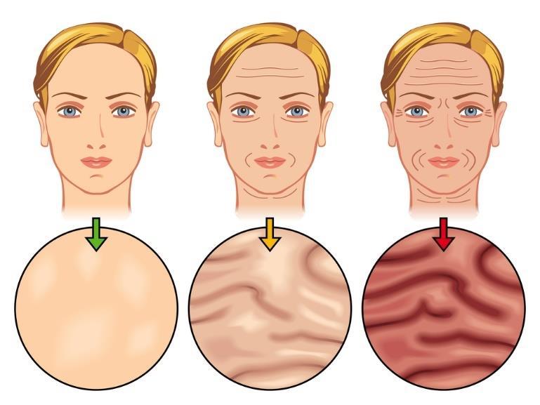 Secrets for a Youthful Neck & Décolletage What is a sagging neck and what causes it? Most everyone, at one point or another, has seen the effects of the dreaded turkey neck.