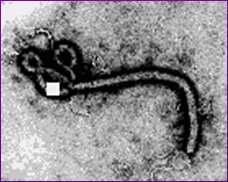 BioSafety Level 4 Examples Ebola