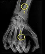 X-RAY OF