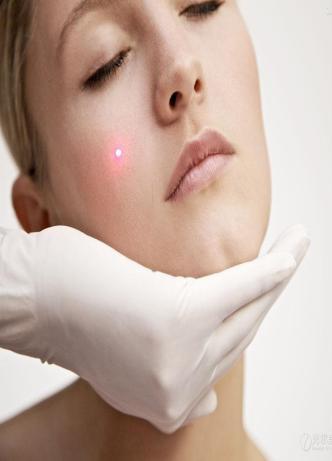 Therapy Technique Principles Epidermal and dermal pigmentation therapy Utilizes the explosive effect of the Nd: YAG laser, which permeates through the epidermis into the dermis containing the pigment