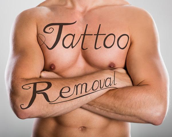 PIGMENT & TATTOO LASER REMOVAL The skill of removing pigment and tattoo using medical laser is highly specialised and targeted at advanced cosmetic practitioners.