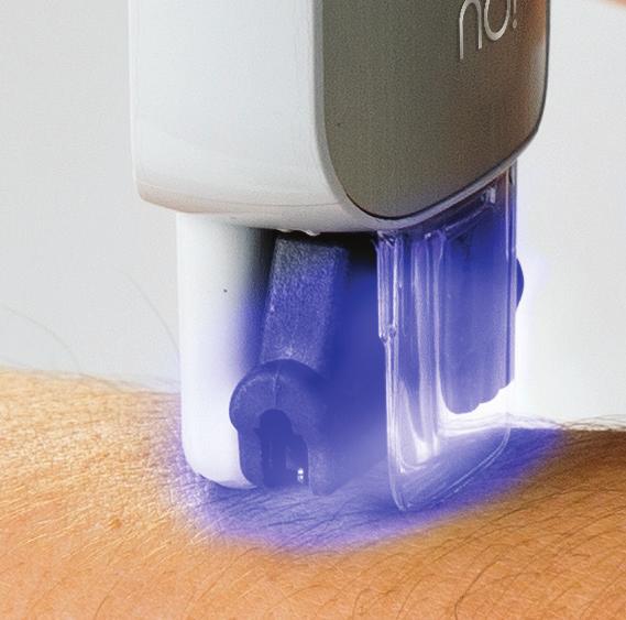 About the Blue and Red Light E The Blue Light under the Thermicon Tip will guide you throughout your treatment. It is visible only when you are gliding no!no! at the proper speed.