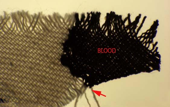 10 Figure 10. Cotton fabric partially soaked with human blood. The dried bloodied area shows no shrinkage. The blood acts to cause some of the cotton fiber bundles to adhere to each other.
