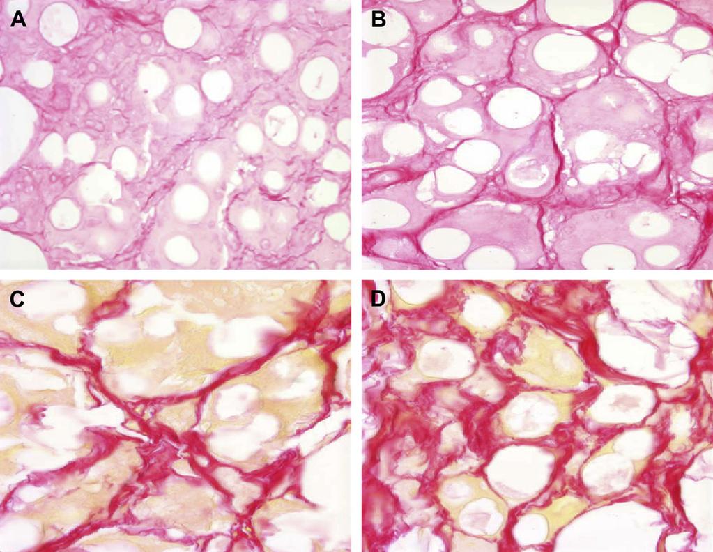434 Jones Fig.1. (A D) Histology studies demonstrate increased collagen deposition around CaHA microspheres over 4 to 78 weeks. Collagen fibers are represented by the darker areas.