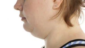 4.9 (97.14%) 7 votes How to Get Rid of a Double Chin Top 10 Home Remedies You can fight with your double chin and win!