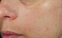 even skin tone 60 % fine lines Based on an 8-week independent US clinical study of 25