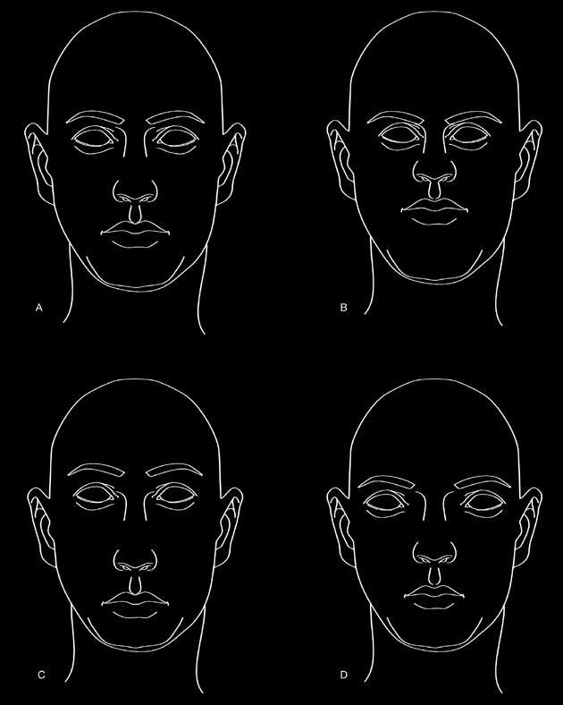161 162 FIG 3 Examples of Alterations to the Positions among Facial Components and the Effect those Positions Have on the Overall Face/Head Composition 163 164 165 166 167 168 169 170 NOTE A - This