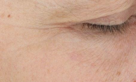 improvement in skin smoothness under the eye 96% showed improvement in the appearance of under-eye radiance Clinical study of 26 participants, % of participants improved vs.