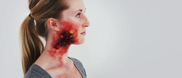 UNIT C: Special FX Makeup for Trauma Understanding Wounds Creating a Bruise Scrapes, Scratches, and Scars Creating Frostbite Effects Decomposition Effects Burn Types