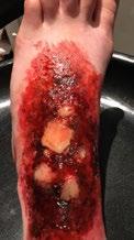 Laura Kaltenbach A variety of special FX looks: 3rd degree burns,