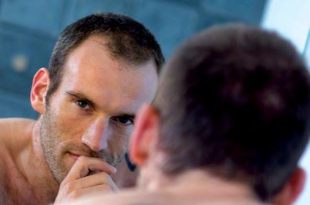 Why am I losing my hair? Hair loss is a significant concern for many men.