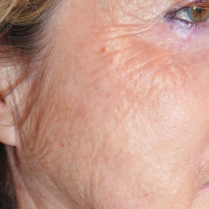 PLURYAL MD SKIN SOLUTIONS LABORATORIES, THE CREATORS BEHIND BEAUTY SCIENCE UNDERSTANDING SKIN AGING > Due to factors such as age, hormone fluctuations in menopause, UV exposure and smoking, the skin