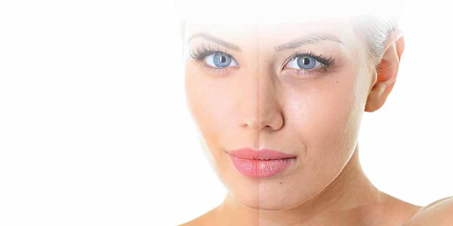 DERMAL FILLERS cont. POSSIBLE SIDE-EFFECTS Some of the side-effects may be rare but serious.