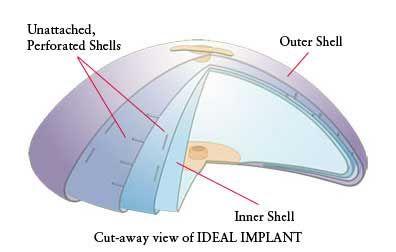 Breast Implants When the time has come for placement of the true breast implant, women have many choices today.