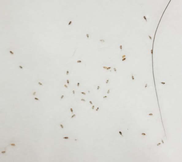 Lice Eggs On Paper Towel